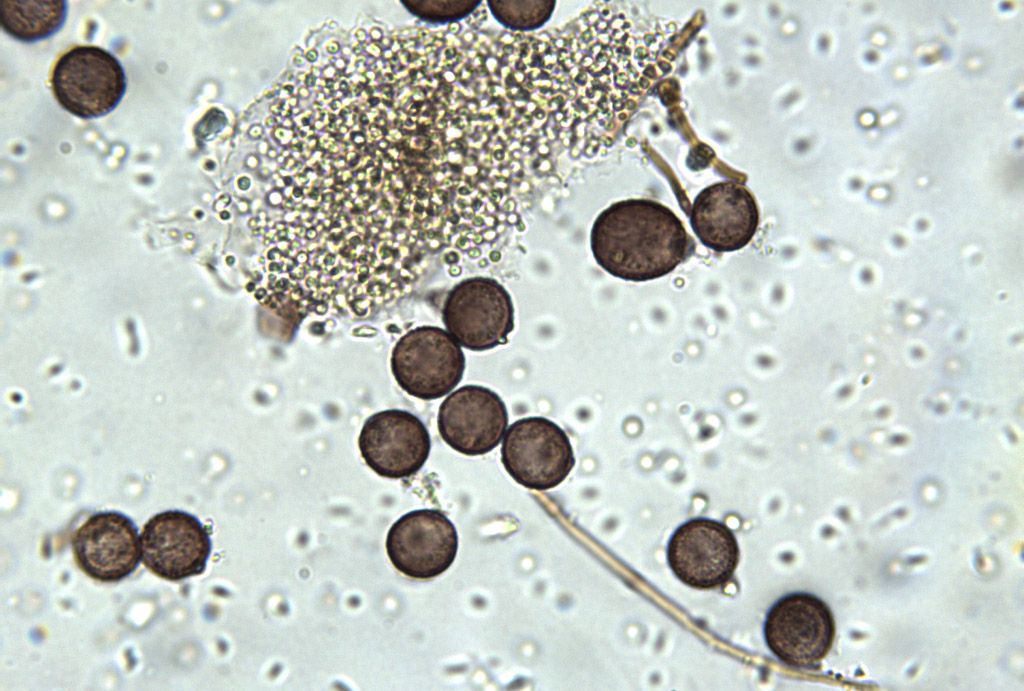 Diderma montanum (?)